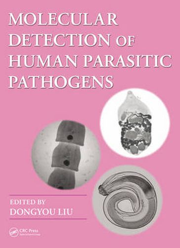 Cover image for Molecular Detection of Human Parasitic Pathogens