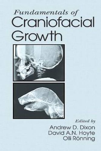 Cover image for Fundamentals of Craniofacial Growth