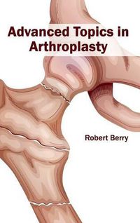 Cover image for Advanced Topics in Arthroplasty