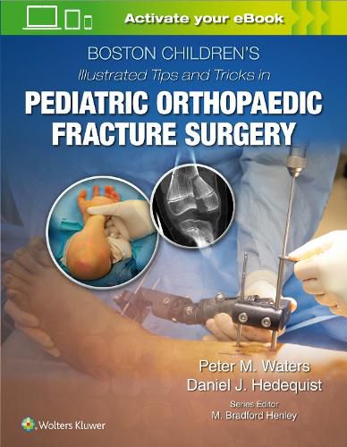 Cover image for Boston Children's Illustrated Tips and Tricks  in Pediatric Orthopaedic Fracture Surgery