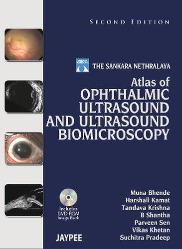 Cover image for Atlas of Ophthalmic Ultrasound and Ultrasound Biomicroscopy