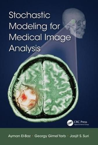 Cover image for Stochastic Modeling for Medical Image Analysis