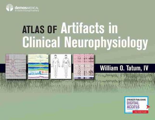Cover image for Artifacts in Clinical Neurophysiology