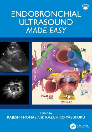 Cover image for Endobronchial Ultrasound Made Easy