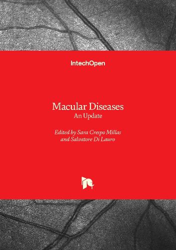 Cover image for Macular Diseases