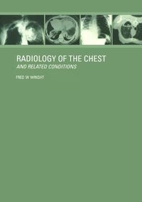 Cover image for Radiology of the Chest and Related Conditions: Together with an extensive illustrative collection of radiographs, conventional and computed tomograms, isotope studies, MRs, etc.on CD-ROM. (Cross-platform for Mac and Windows version 3.1 or later)