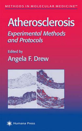 Cover image for Atherosclerosis: Experimental Methods and Protocols