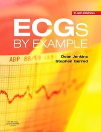 Cover image for ECGs by Example