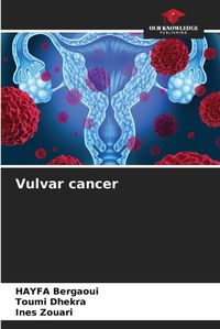 Cover image for Vulvar cancer