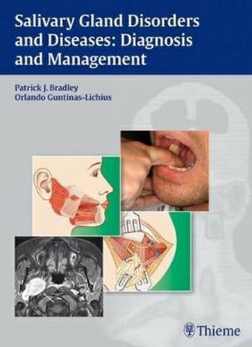 Cover image for Salivary Gland Disorders and Diseases:: Diagnosis and Management