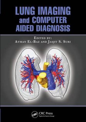 Cover image for Lung Imaging and Computer Aided Diagnosis