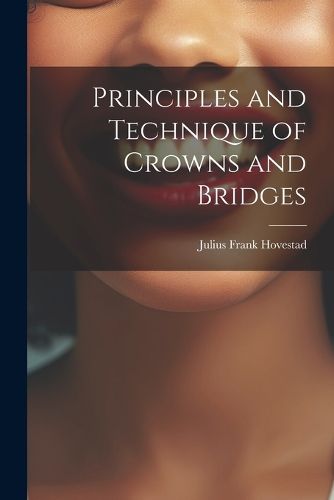 Cover image for Principles and Technique of Crowns and Bridges
