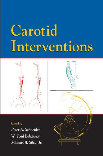 Cover image for Carotid Interventions