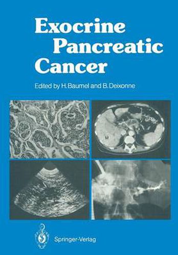 Cover image for Exocrine Pancreatic Cancer