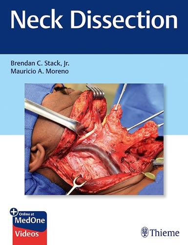 Cover image for Neck Dissection