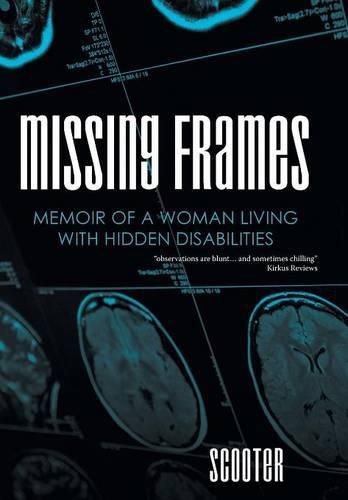 Cover image for Missing Frames