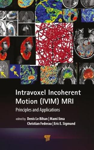 Cover image for Intravoxel Incoherent Motion (IVIM) MRI: Principles and Applications