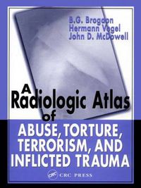 Cover image for A Radiologic Atlas of Abuse, Torture, Terrorism, and Inflicted Trauma