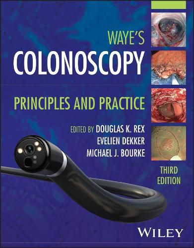 Cover image for Colonoscopy