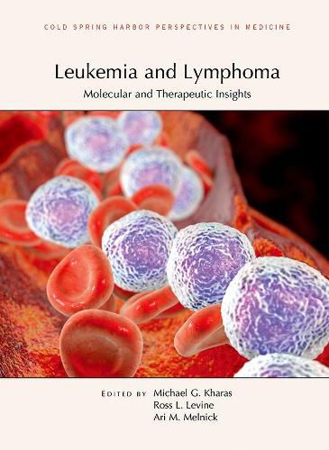 Cover image for Leukemia and Lymphoma: Molecular and Therapeutic Insights