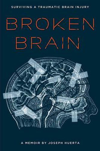 Cover image for Broken Brain