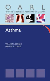 Cover image for Asthma