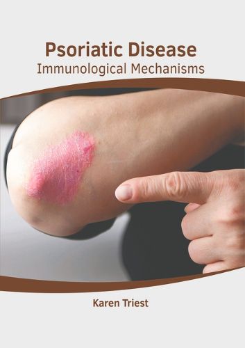 Cover image for Psoriatic Disease: Immunological Mechanisms
