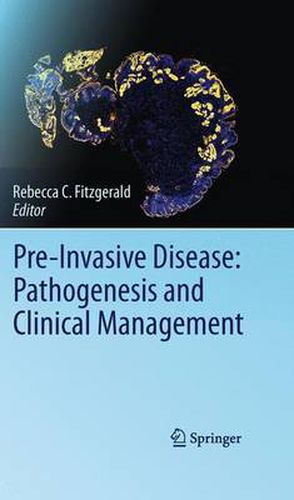 Cover image for Pre-Invasive Disease: Pathogenesis and Clinical Management