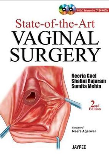 Cover image for State-of-the-Art Vaginal Surgery