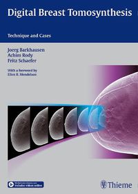 Cover image for Digital Breast Tomosynthesis: Technique and Cases