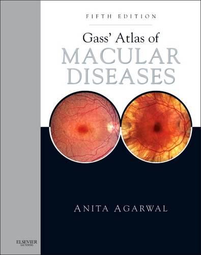 Cover image for Gass' Atlas of Macular Diseases: 2-Volume Set - Expert Consult: Online and Print