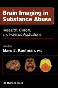 Cover image for Brain Imaging in Substance Abuse: Research, Clinical, and Forensic Applications