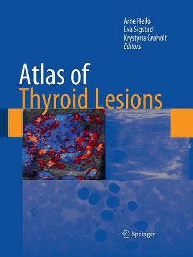 Cover image for Atlas of Thyroid Lesions