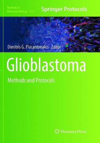Cover image for Glioblastoma: Methods and Protocols