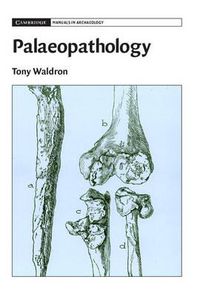 Cover image for Palaeopathology