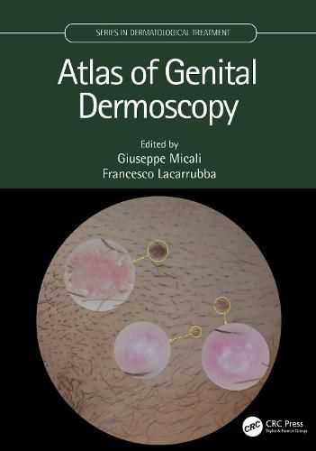 Cover image for Atlas of Genital Dermoscopy