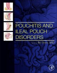 Cover image for Pouchitis and Ileal Pouch Disorders: A Multidisciplinary Approach for Diagnosis and Management