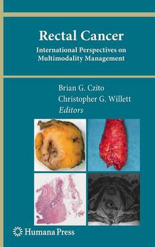 Cover image for Rectal Cancer: International Perspectives on Multimodality Management