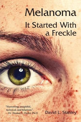 Cover image for Melanoma: It Started With a Freckle