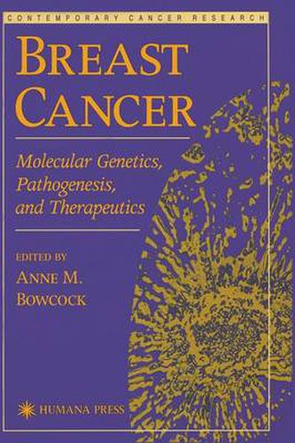 Cover image for Breast Cancer: Molecular Genetics, Pathogenesis, and Therapeutics