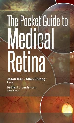Cover image for The Pocket Guide to Medical Retina