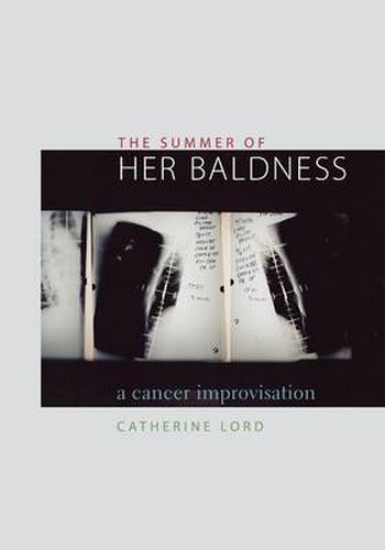 Cover image for The Summer of Her Baldness: A Cancer Improvisation