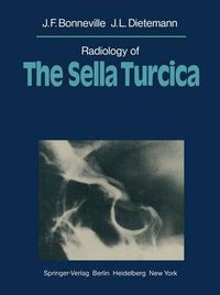 Cover image for Radiology of The Sella Turcica