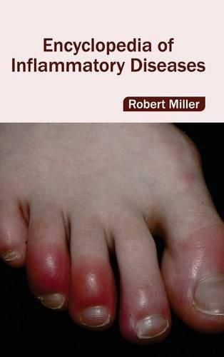 Cover image for Encyclopedia of Inflammatory Diseases