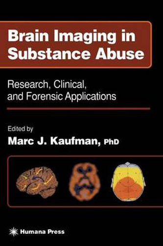 Brain Imaging in Substance Abuse: Research, Clinical, and Forensic Applications