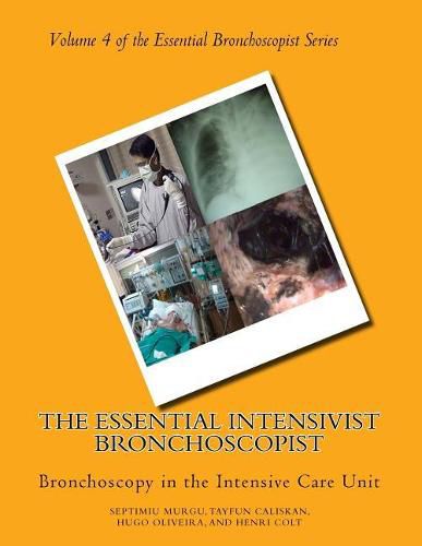 Cover image for The Essential Intensivist Bronchoscopist: Bronchoscopy in the Intensive Care Unit