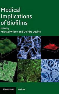 Cover image for Medical Implications of Biofilms