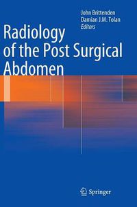 Cover image for Radiology of the Post Surgical Abdomen