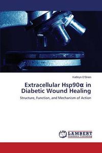 Cover image for Extracellular Hsp90&#945; in Diabetic Wound Healing