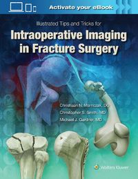 Cover image for Illustrated Tips and Tricks for Intraoperative Imaging in Fracture Surgery